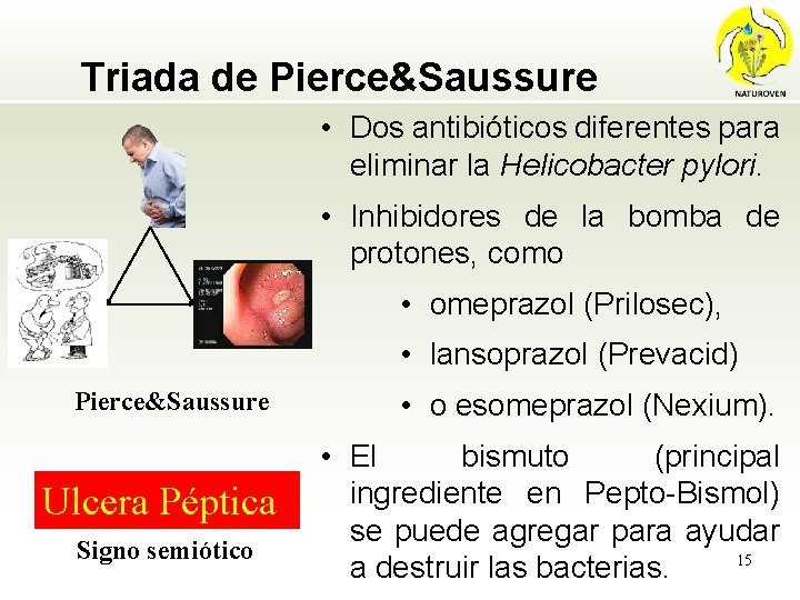 Triada de Pierce&Saussure • Dos antibióticos diferentes para eliminar la Helicobacter pylori. • Inhibidores