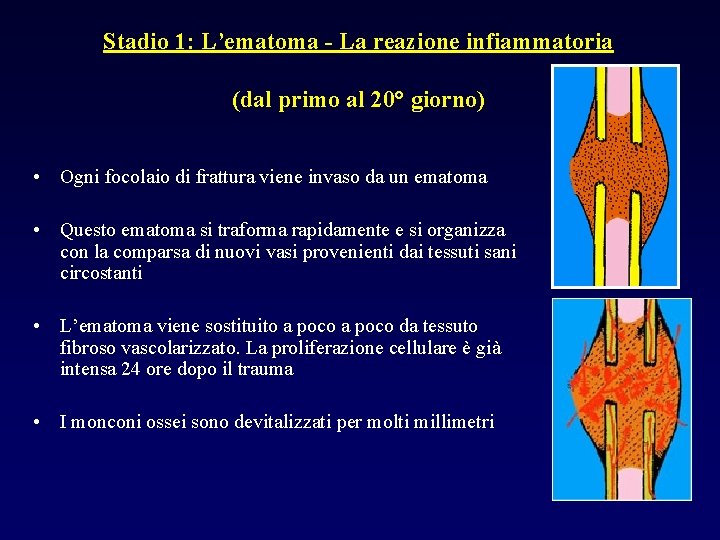 Stadio 1: L’ematoma - La reazione infiammatoria (dal primo al 20° giorno) • Ogni