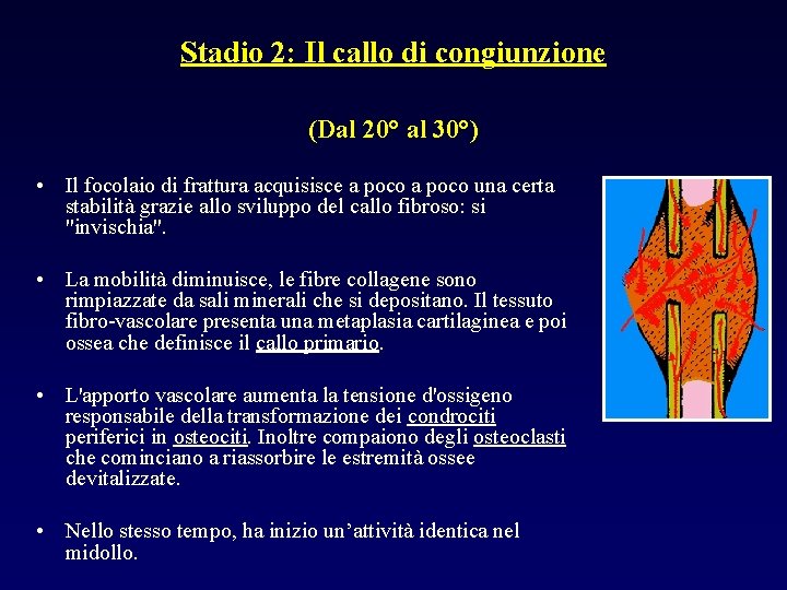 Stadio 2: Il callo di congiunzione (Dal 20° al 30°) • Il focolaio di