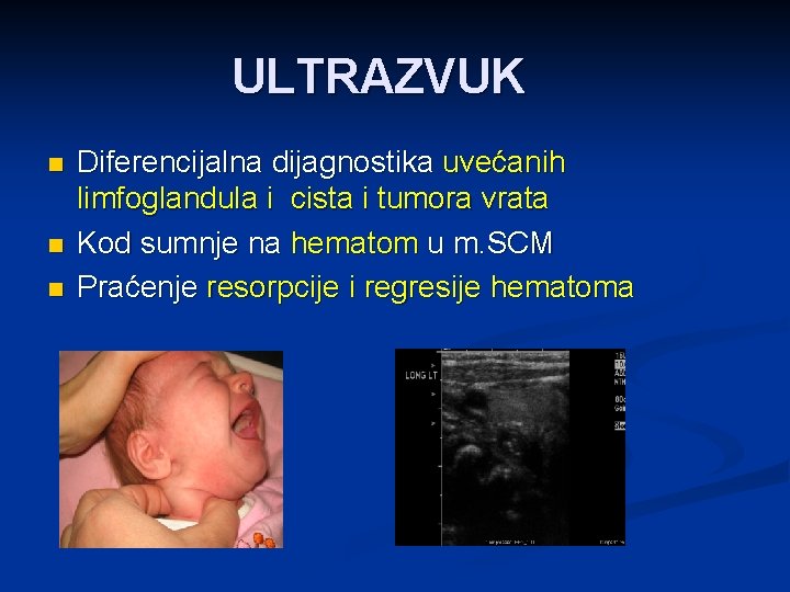 ULTRAZVUK n n n Diferencijalna dijagnostika uvećanih limfoglandula i cista i tumora vrata Kod