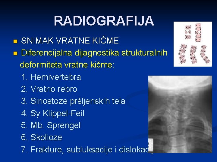 RADIOGRAFIJA SNIMAK VRATNE KIČME n Diferencijalna dijagnostika strukturalnih deformiteta vratne kičme: 1. Hemivertebra 2.