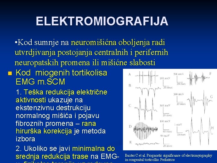 ELEKTROMIOGRAFIJA • Kod sumnje na neuromišićna oboljenja radi utvrdjivanja postojanja centralnih i perifernih neuropatskih