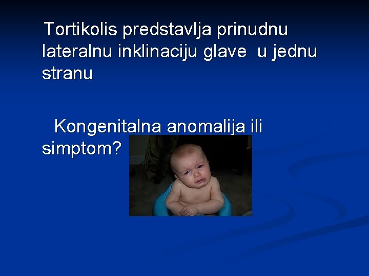 Tortikolis predstavlja prinudnu lateralnu inklinaciju glave u jednu stranu Kongenitalna anomalija ili simptom? 