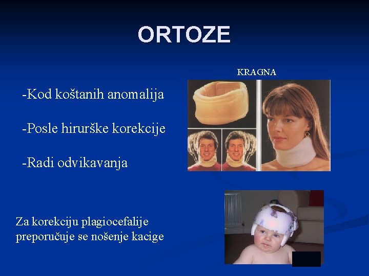 ORTOZE KRAGNA -Kod koštanih anomalija -Posle hirurške korekcije -Radi odvikavanja Za korekciju plagiocefalije preporučuje