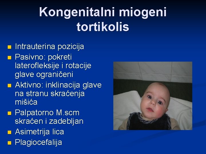Kongenitalni miogeni tortikolis n n n Intrauterina pozicija Pasivno: pokreti laterofleksije i rotacije glave