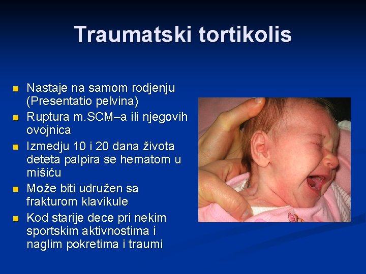 Traumatski tortikolis n n n Nastaje na samom rodjenju (Presentatio pelvina) Ruptura m. SCM–a