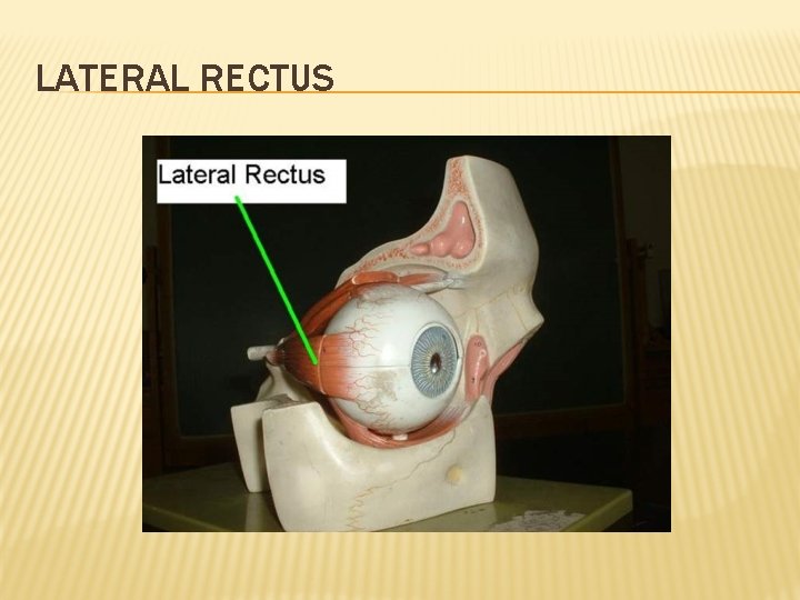 LATERAL RECTUS 