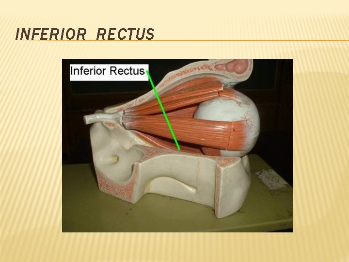 INFERIOR RECTUS 