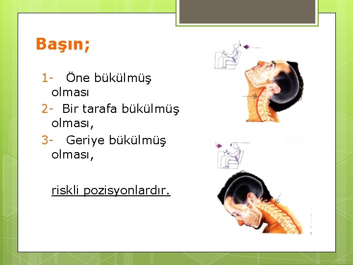 Başın; 1 - Öne bükülmüş olması 2 - Bir tarafa bükülmüş olması, 3 -