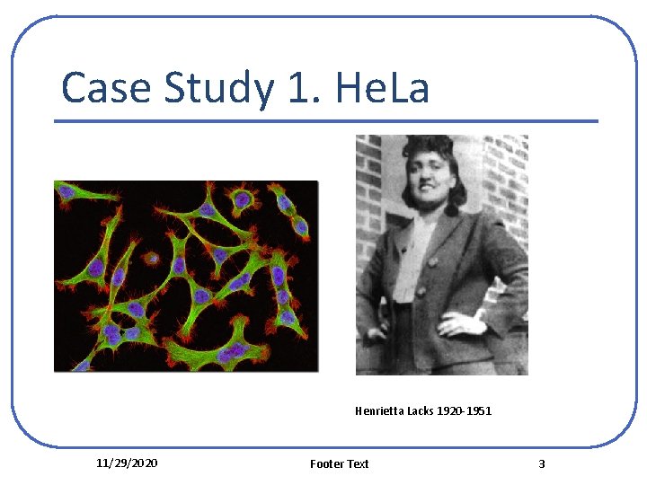 Case Study 1. He. La Henrietta Lacks 1920 -1951 11/29/2020 Footer Text 3 Case Study 1. He. La Henrietta Lacks 1920 -1951 11/29/2020 Footer Text 3