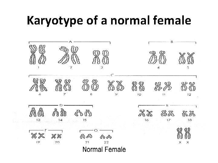 Karyotype of a normal female 