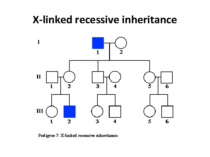 X-linked recessive inheritance 
