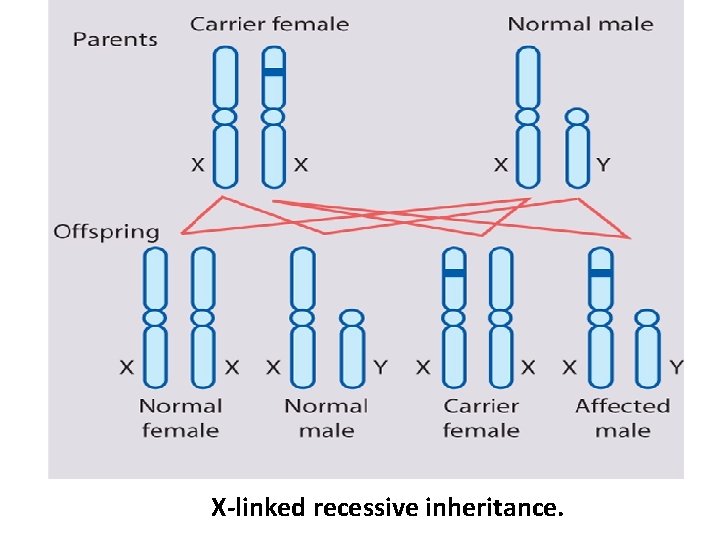 X-linked recessive inheritance. 