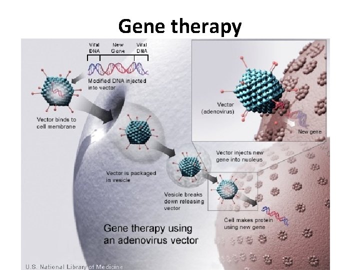 Gene therapy 