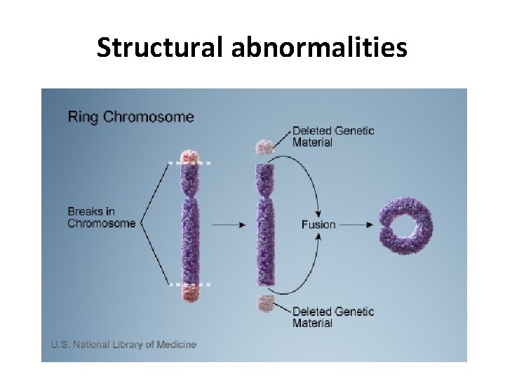 Structural abnormalities 