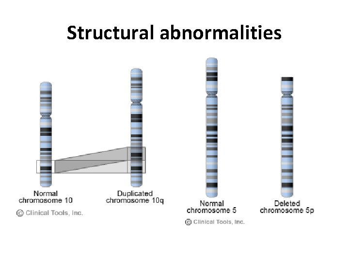 Structural abnormalities 