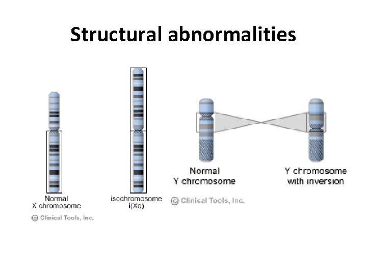 Structural abnormalities 