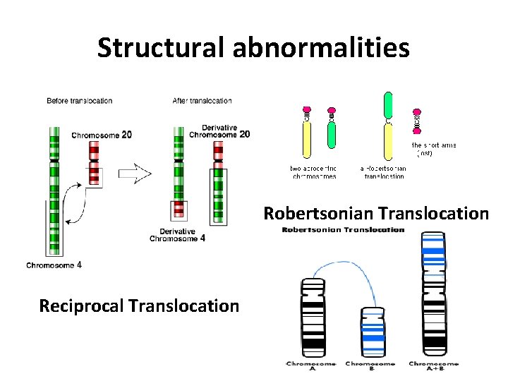 Structural abnormalities Robertsonian Translocation Reciprocal Translocation 