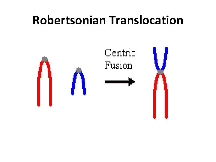 Robertsonian Translocation 