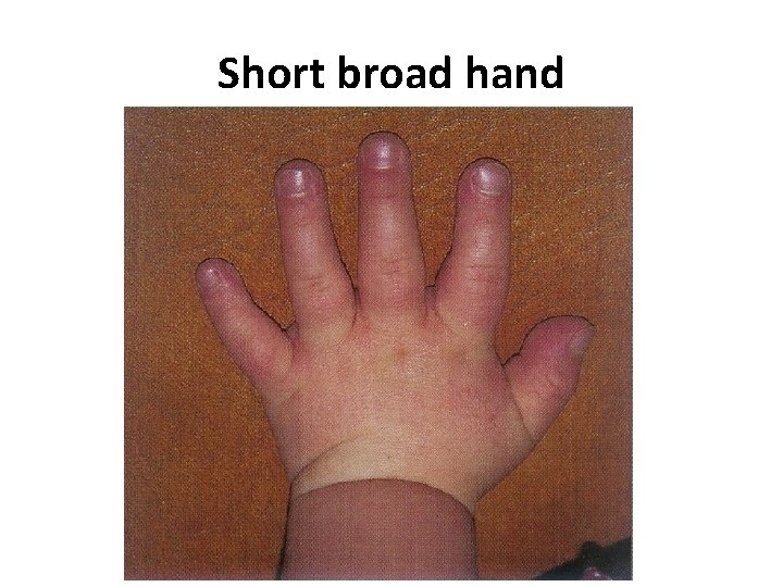 Short broad hand 