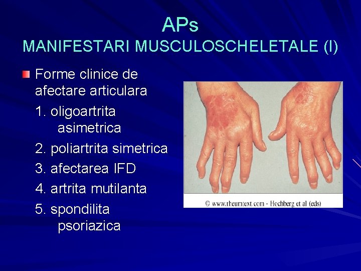 artrita psoriazica definitie