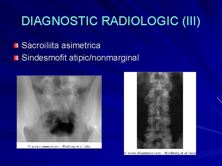 mono oligoartrita asimetrica durere la nivelul coloanei vertebrale și al articulațiilor