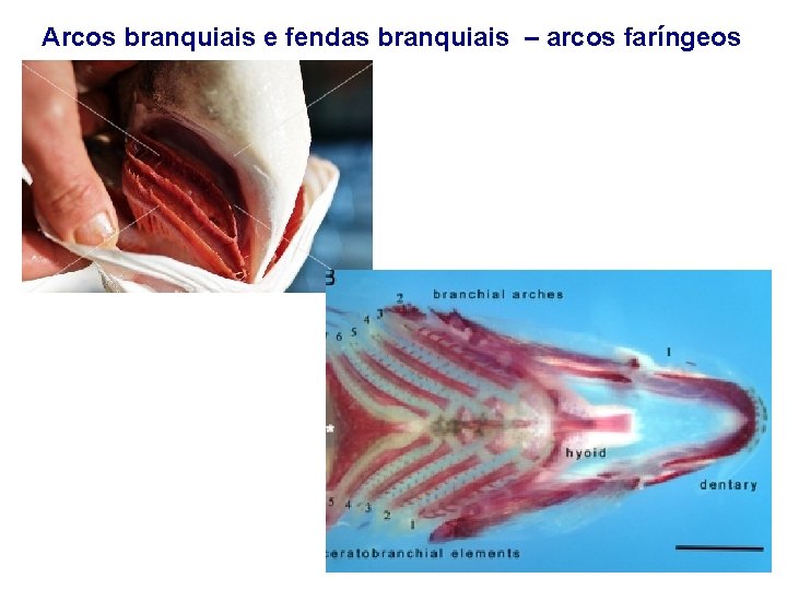 Arcos branquiais e fendas branquiais – arcos faríngeos 