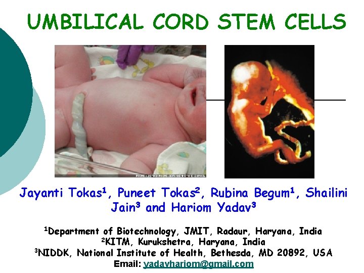 UMBILICAL CORD STEM CELLS Jayanti Tokas 1, Puneet Tokas 2, Rubina Begum 1, Shailini