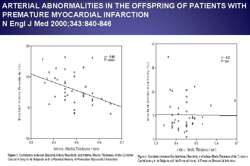 ARTERIAL ABNORMALITIES IN THE OFFSPRING OF PATIENTS WITH PREMATURE MYOCARDIAL INFARCTION N Engl J ARTERIAL ABNORMALITIES IN THE OFFSPRING OF PATIENTS WITH PREMATURE MYOCARDIAL INFARCTION N Engl J