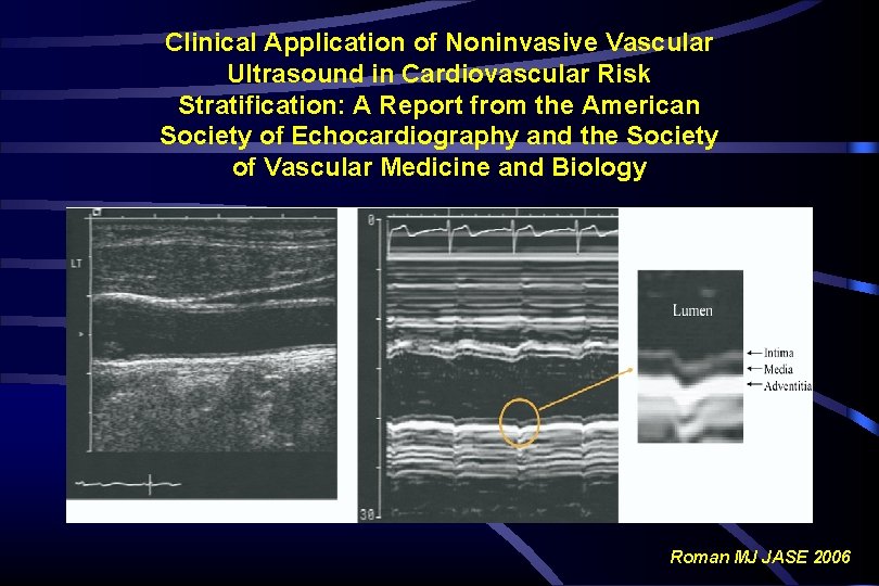 Clinical Application of Noninvasive Vascular Ultrasound in Cardiovascular Risk Stratification: A Report from the Clinical Application of Noninvasive Vascular Ultrasound in Cardiovascular Risk Stratification: A Report from the