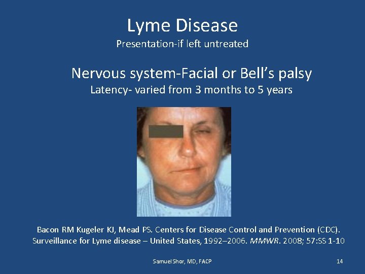 Lyme Disease Presentation-if left untreated Nervous system-Facial or Bell’s palsy Latency- varied from 3