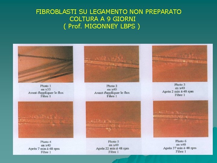  FIBROBLASTI SU LEGAMENTO NON PREPARATO COLTURA A 9 GIORNI ( Prof. MIGONNEY LBPS