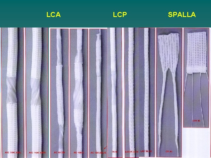 LCA LCP SPALLA 