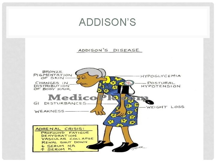 ADDISON’S ADDISON’S