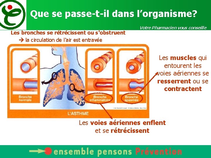 Que se passe-t-il dans l’organisme? Les bronches se rétrécissent ou s'obstruent la circulation de