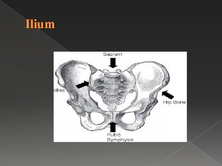 Ilium 