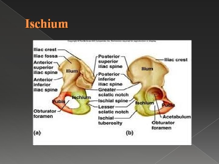 Ischium 