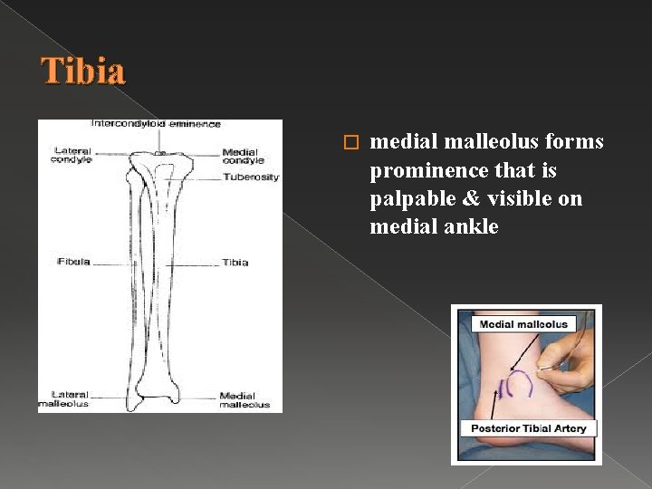 Tibia � medial malleolus forms prominence that is palpable & visible on medial ankle