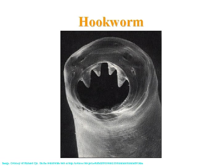 Hookworm Image: Courtesy of Richard Cyr. On the world wide web at http: //courses.