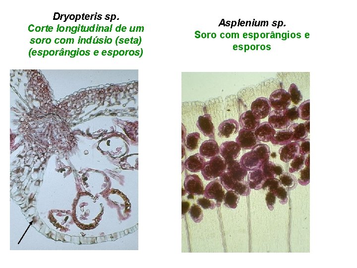 Dryopteris sp. Corte longitudinal de um soro com indúsio (seta) (esporângios e esporos) Asplenium