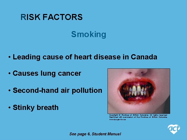 RISK FACTORS Smoking • Leading cause of heart disease in Canada • Causes lung