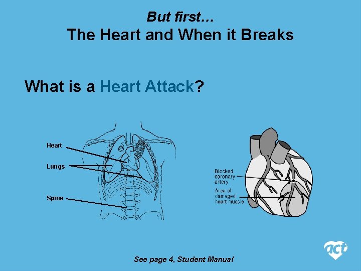 But first… The Heart and When it Breaks What is a Heart Attack? Heart