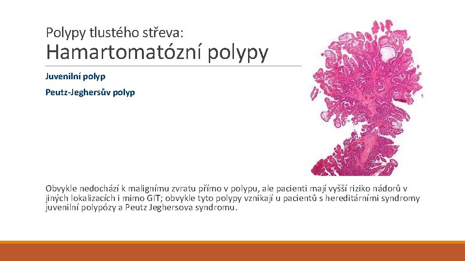 Polypy tlustého střeva: Hamartomatózní polypy Juvenilní polyp Peutz-Jeghersův polyp Obvykle nedochází k malignímu zvratu