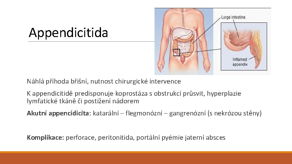 Appendicitida Náhlá příhoda břišní, nutnost chirurgické intervence K appendicitidě predisponuje koprostáza s obstrukcí průsvit,