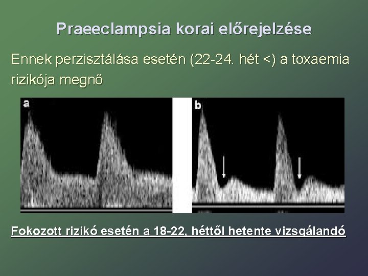 Praeeclampsia korai előrejelzése Ennek perzisztálása esetén (22 -24. hét <) a toxaemia rizikója megnő