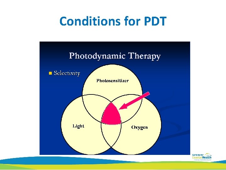 Conditions for PDT 