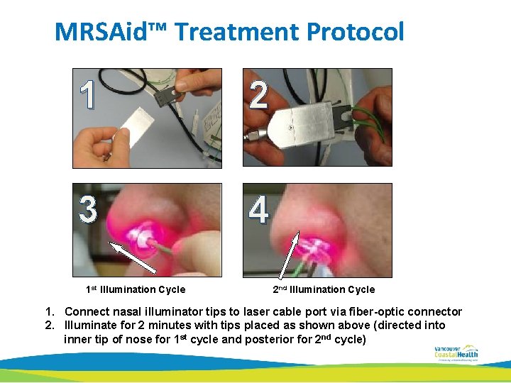 MRSAid™ Treatment Protocol 1 2 3 4 1 st Illumination Cycle 2 nd Illumination