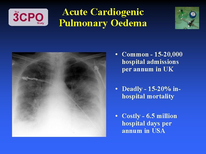 The 3 CPO Study Acute Cardiogenic Pulmonary Oedema • Common - 15 -20, 000