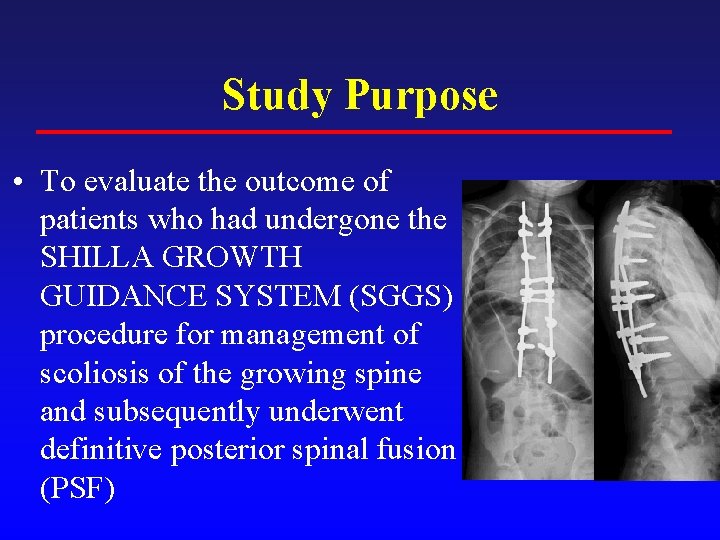 Study Purpose • To evaluate the outcome of patients who had undergone the SHILLA