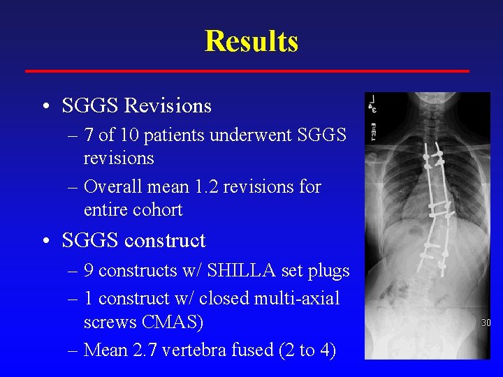 Results • SGGS Revisions – 7 of 10 patients underwent SGGS revisions – Overall